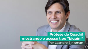 Prótese Total de quadril: o acesso feito no tipo “biquíni”￼